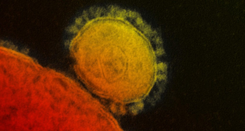 Σ. Αραβία: 121 νεκροί από τον κορονοϊό MERS