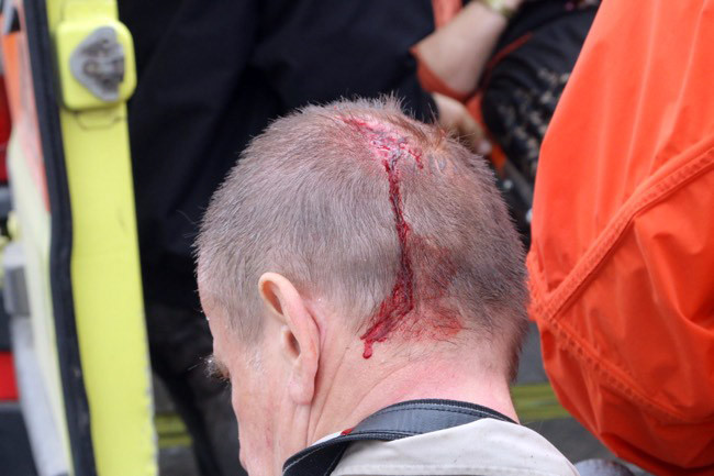 Κεραυνός “χτύπησε” 19 Ρώσους τουρίστες στην Κνωσό! – Ανάνηψη σε έγκυο γυναίκα (upd) (εικόνες)