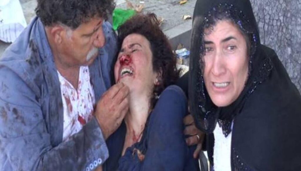 Σκηνές φρίκης στην Τουρκία: Τουλάχιστον 20 οι νεκροί σύμφωνα με πρώτο απολογισμό – Αναφέρουν για επίθεση καμικάζι [φωτο-βίντεο]