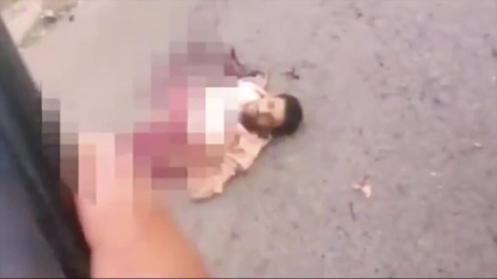 Διαμελισμένος ισλαμιστής αυτοκτονίας επιζεί και ζητά τις “παρθένες” του! [σκληρό βίντεο]