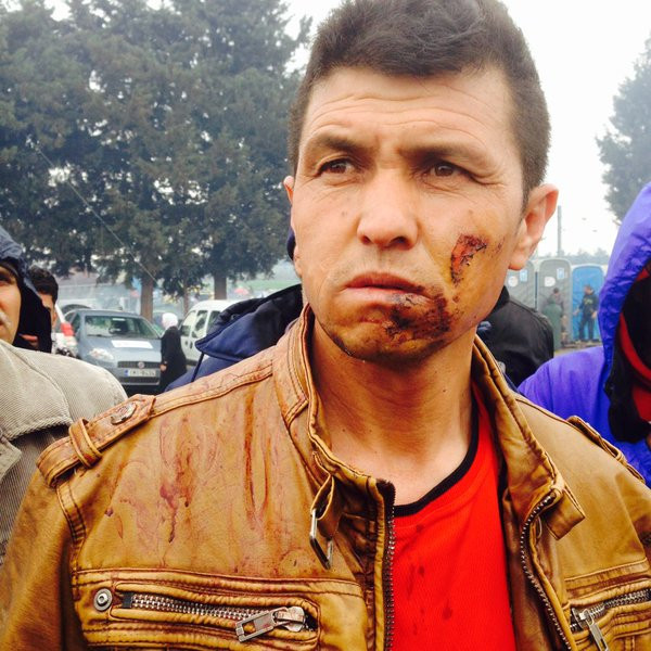 Πρόσφυγες καταγγέλλουν ότι οι Σκοπιανοί τους ξυλοφόρτωσαν πριν τους στείλουν πίσω στην Ελλάδα [φωτό]