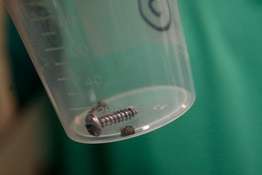 Βρυξέλλες: Γεμάτες καρφιά και βίδες οι βόμβες των μακελάρηδων (φωτό)