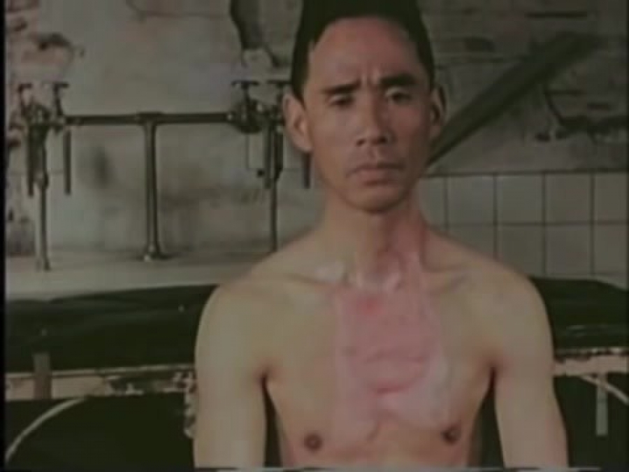 Ιάπωνες-θύματα εγκαυμάτων από τον βομβαρδισμό της Χιροσίμα! (Σκληρό βίντεο)