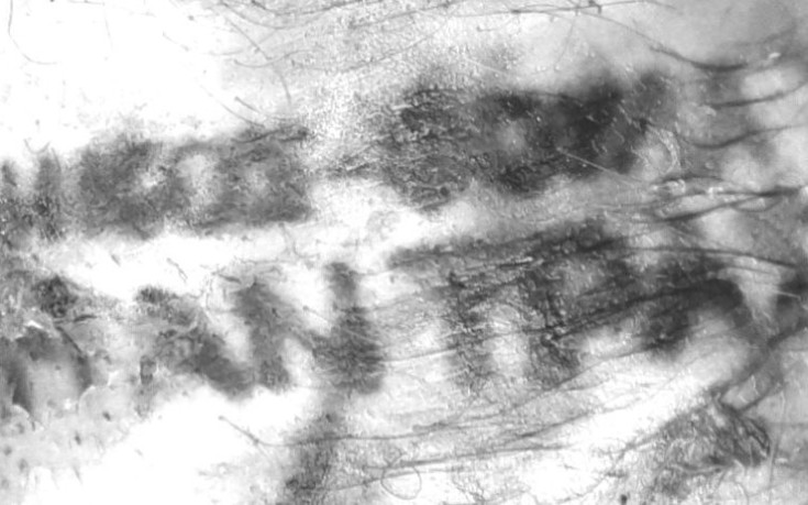 Eγκλημα στα λιμανάκια: «Τον χτύπησα με πέτρα στο κεφάλι και μετά του έβαλα φωτιά»