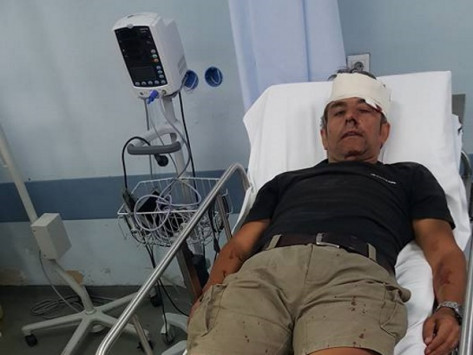 Ο τραυματισμένος φωτορεπόρτερ μετά την επίθεση των κουκουλοφόρων (φωτό)