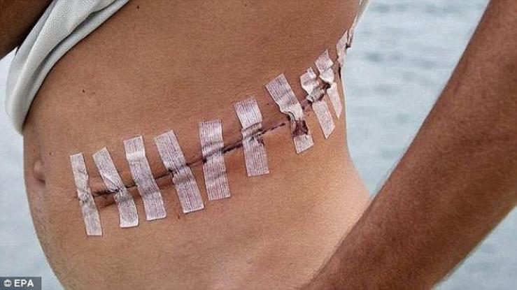 Φρίκη! Οι ισλαμιστές της ISIS κλέβουν όργανα από τους νεκρούς και τους τραυματίες τους (φωτό)