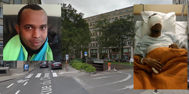 Έβγαλαν τα μάτια ανθρώπου στη μέση του δρόμου στις Βρυξέλλες (φωτο)