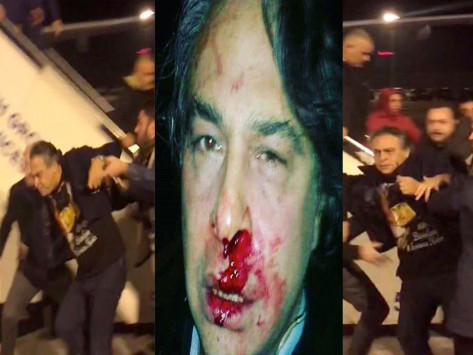 Ομάδα κουκουλοφόρων ξυλοκόπησε Τούρκο σχεδιαστή μόδας επειδή γιόρτασε την Πρωτοχρονιά (φωτό, βίντεο)