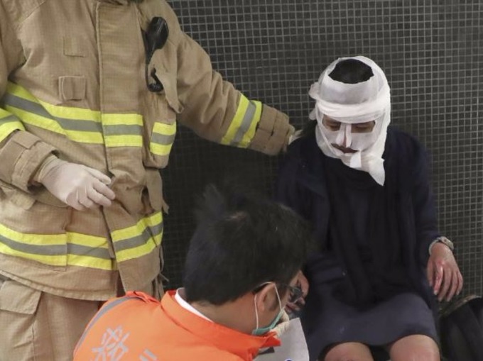 Χονγκ Κονγκ: Πυρομανής έβαλε φωτιά σε βαγόνι του μετρό και τραυμάτισε τουλάχιστον 18 άτομα (φωτό, βίντεο)