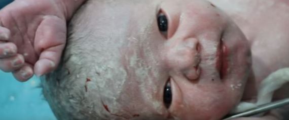 Γιατροί επαναφέρουν στην ζωή μωρό που γεννήθηκε σε βομβαρδισμό στην Συρία (βίντεο)