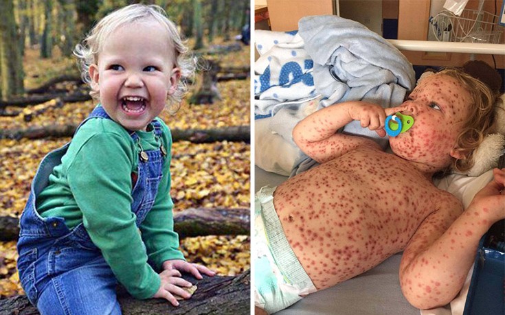 Αγγλία: Επιτήδειοι παρουσίασαν αγοράκι με ανεμοβλογιά ως καρκινοπαθή στο Facebook!