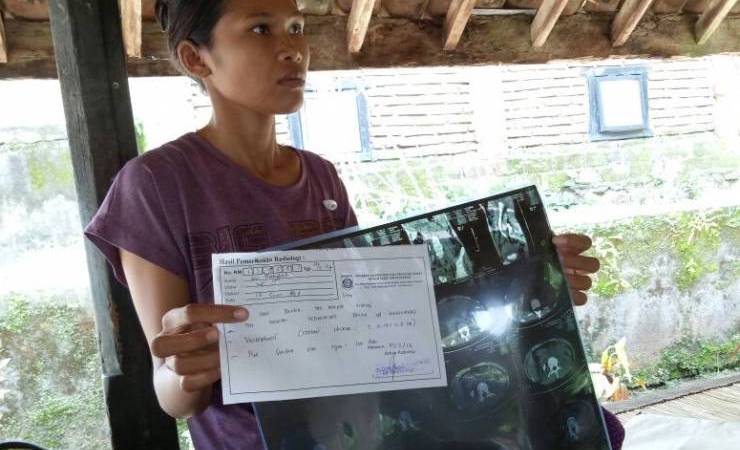 Γυναίκα πήγε για δουλειά στο Κατάρ και της έκλεψαν το νεφρό (φωτό, βίντεο)