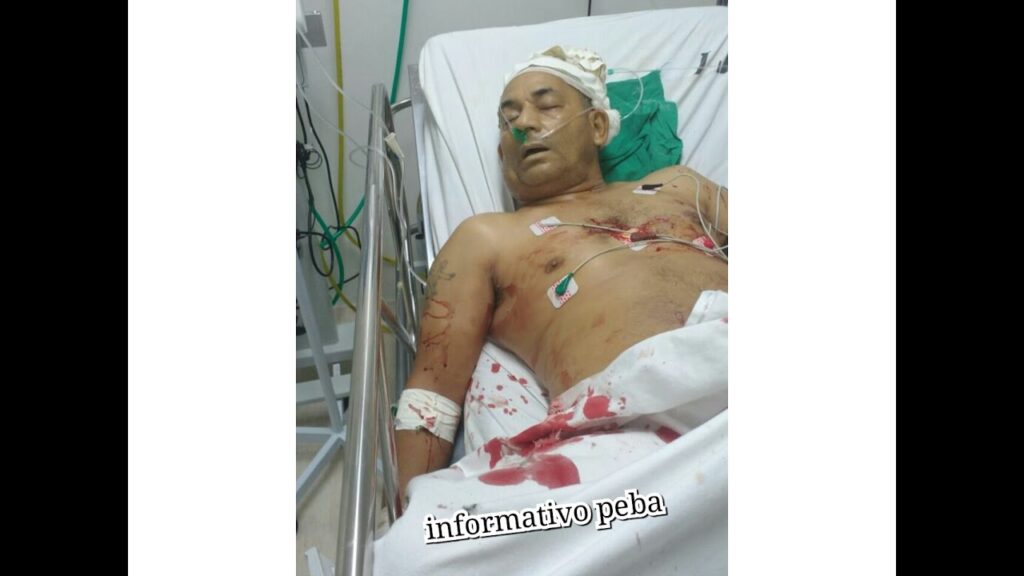 Βραζιλία: Ένοπλοι εισέβαλαν σε νοσοκομείο και δολοφόνησαν ακτιβιστή που ανάρρωνε (βίντεο)