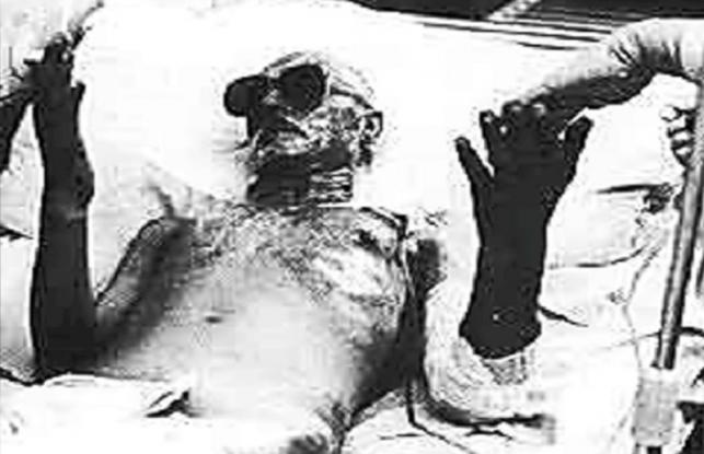 Τσέρνομπιλ: Όταν «άνοιξε η κόλαση» – Οι άγνωστοι ήρωες που έλιωσαν ζωντανοί από τη ραδιενέργεια! (φωτό & βίντεο)