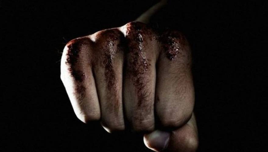 Κι όμως έγινε! Του έσπασε τη μύτη γιατί τον … ξύπνησε σε λάθος στάση (βίντεο)