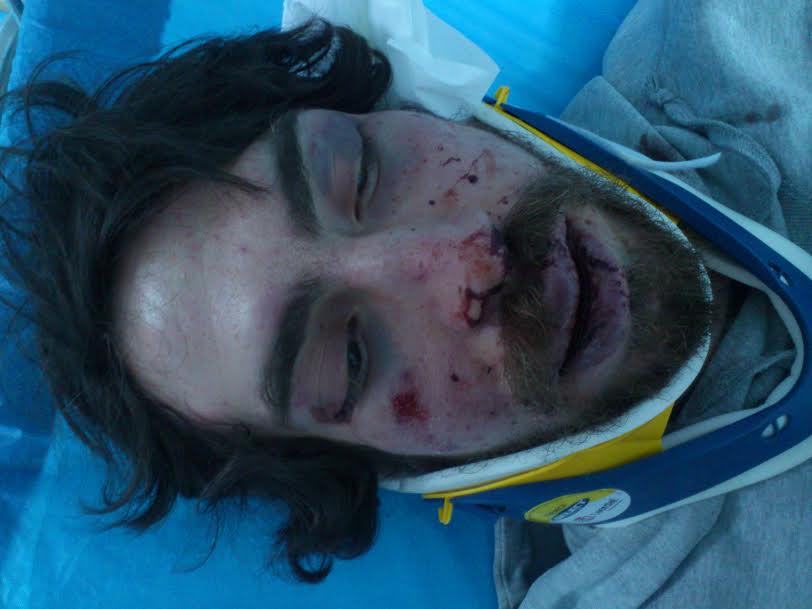 Θύμα άγριου ξυλοδαρμού έπεσε 20χρονος φοιτητής από κουκουλοφόρους στην περιοχή των Ελληνορώσων (φωτό)