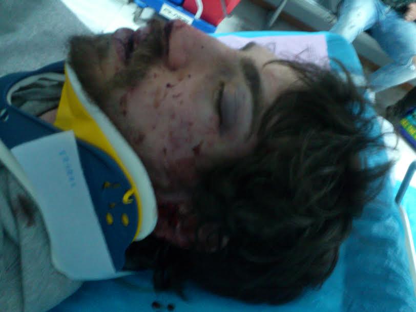 Σοκάρουν οι φωτό από τον άγριο ξυλοδαρμό του φοιτητή – ΕΛ.ΑΣ: «Όλα δείχνουν ότι στόχος των δραστών ήταν το σακίδιο»