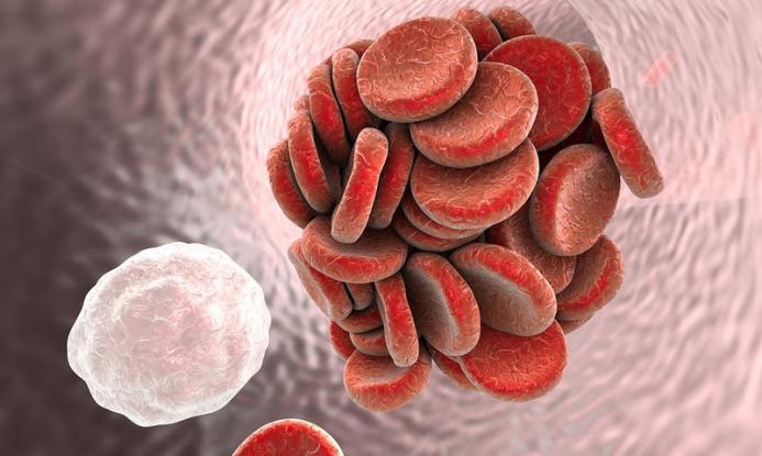 Θρόμβωση: Οι τροφές που αυξάνουν τον κίνδυνο και ο ρόλος της ασπιρίνης!