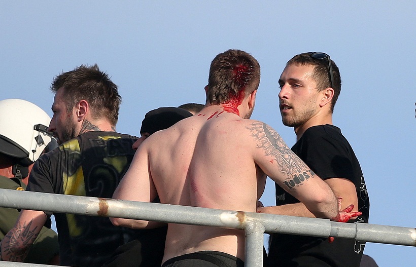 Τελικός Κυπέλλου: Όλες οι συμπλοκές οπαδών- Αστυνομίας (φωτό)