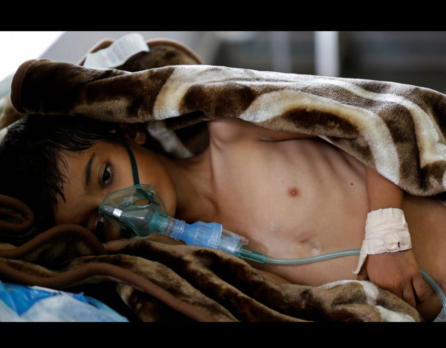 Υεμένη: Η Σαουδική Αραβία «σπρώχνει» τους κατοίκους σε λιμό χολέρας