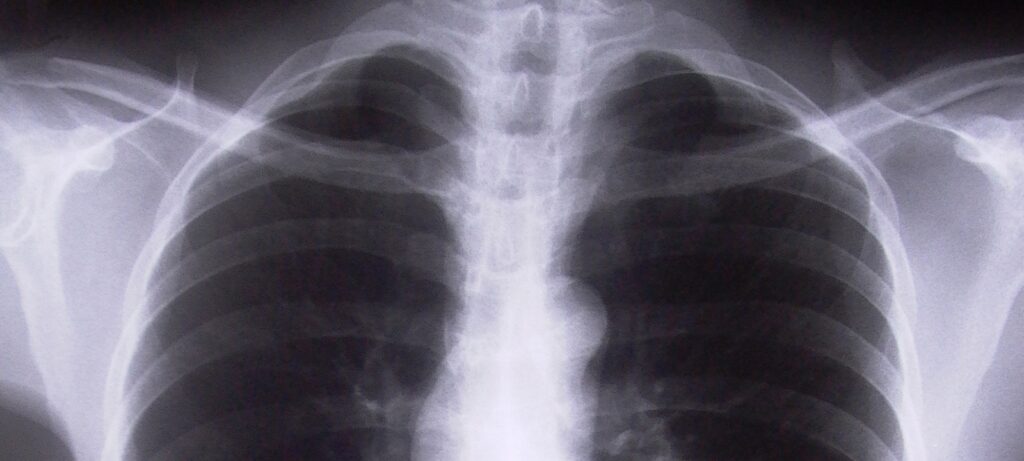 Φρικιαστική υπόθεση στο Ηράκλειο: Ακτινογραφία 17χρονης μαθήτριας αποκάλυψε την κακοποίηση που δέχτηκε από 45χρονο