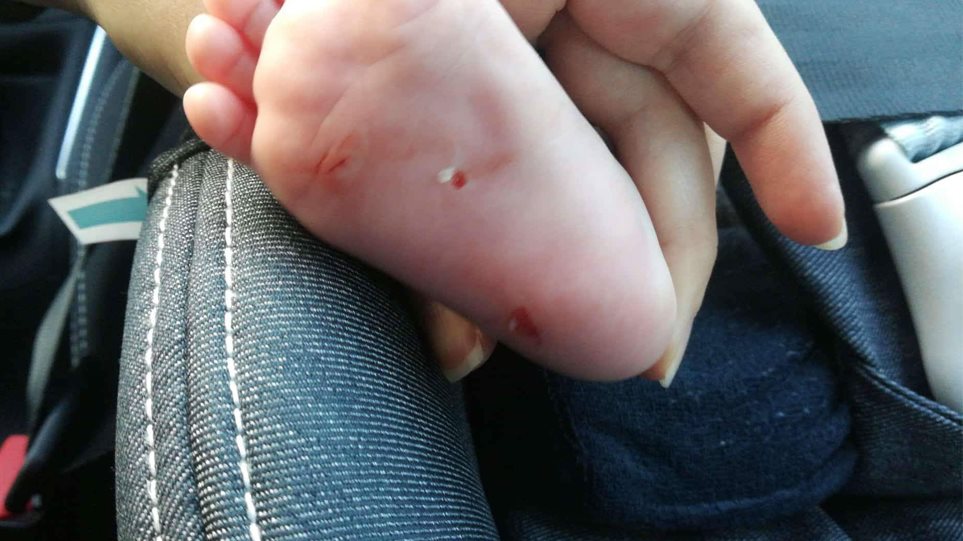 Αύριο θα δικαστεί η γυναίκα που χαράκωνε μωρά