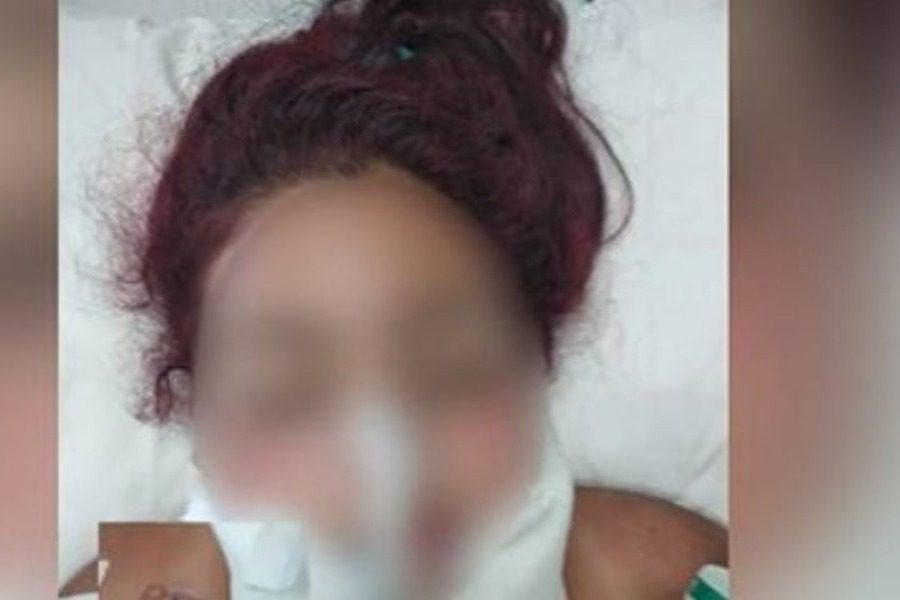 Δόθηκε στην δημοσιότητα η φωτογραφία της κοπέλας που βιάστηκε στο Ζεφύρι και είναι σε κώμα