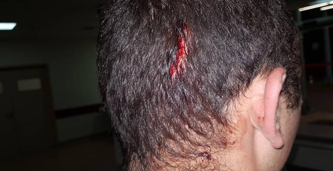 Από θαύμα σώθηκαν οι αστυνομικοί από τους Ρομά: Δεν λειτουργούσε ο ασύρματος & ειδοποίησαν με το κινητό!