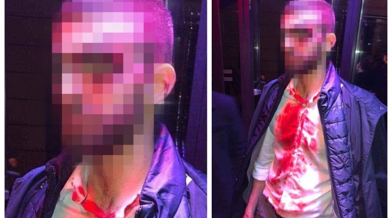 Βίντεο: Πώς ξεκίνησε η σύρραξη στο μαγαζί που τραγουδάει ο Σαμπάνης- Με 120 ράμματα ο νεαρός θαμώνας