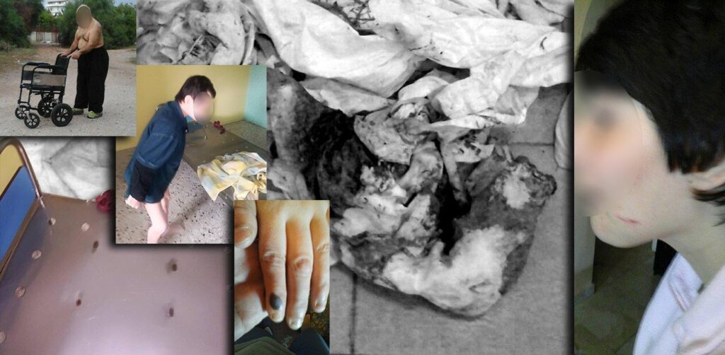 Αποτρόπαιες εικόνες από το πρώην Λοιμωδών – Παιδιά ναρκωμένα & δεμένα σαν άγρια ζώα ανάμεσα σε ακαθαρσίες & ούρα (φώτο)