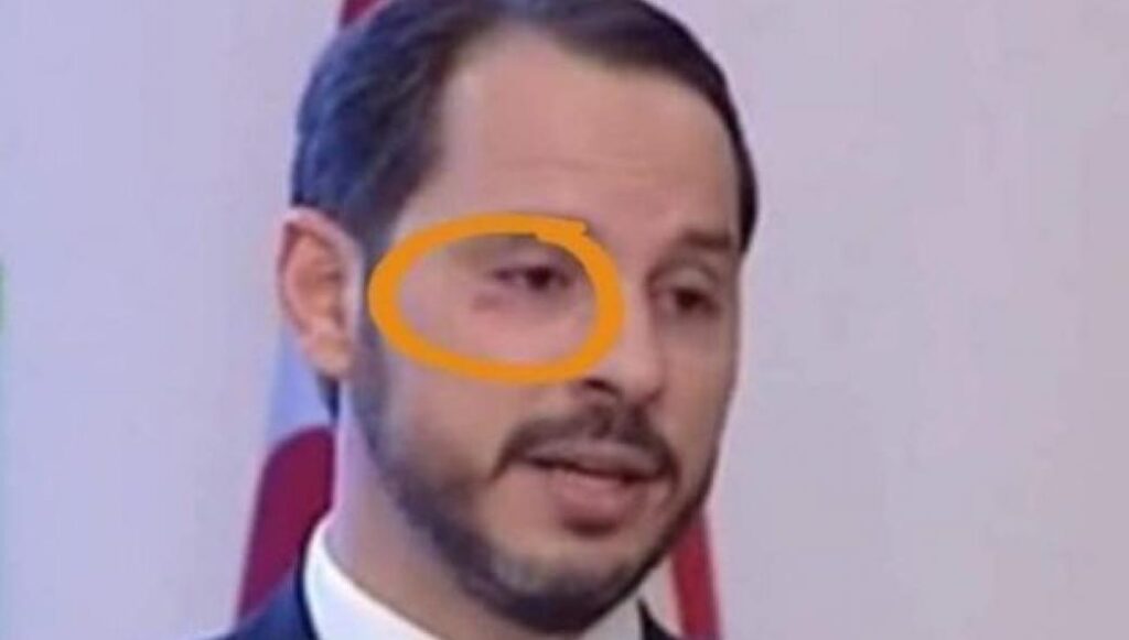 Έδειραν τον Αλμπαϊράκ στο κότερο του Γιλντιρίμ επειδή «κεράτωσε» την κόρη του Ερντογάν; (φώτο)