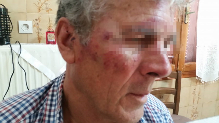 Σάμος: Τούρκοι ξυλοκόπησαν 73χρονο που άκουγε εκκλησιαστική μουσική! (φώτο)