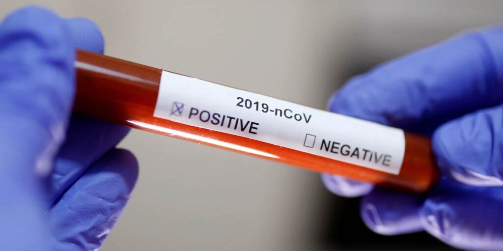 Δύο διαφορετικά αποτελέσματα είχαν τα τεστ κορωνοϊού που έκανε ο  αρχηγός της Εθνοφρουράς των ΗΠΑ