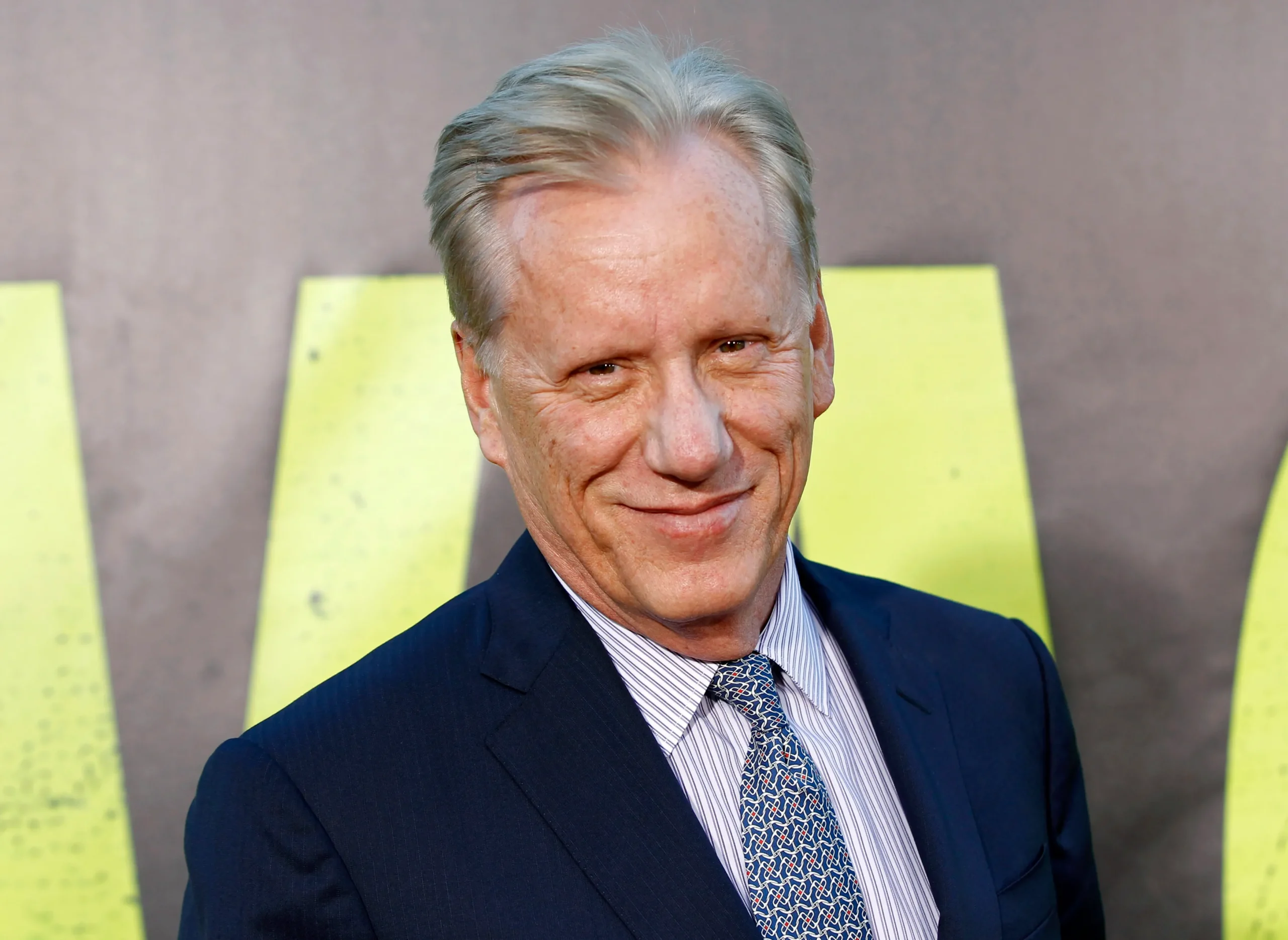 James Woods: «Δηλητηριώδες» σχόλιο κατά Ζελένσκι από τον διάσημο Αμερικανό ηθοποιό