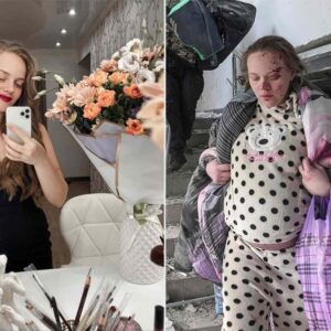 Που βρίσκεται τώρα η Μαριάνα που το 2022 είχε πει ότι το νοσοκομείο της Μαριούπολης χτυπήθηκε από τους Ουκρανούς