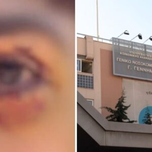 Ξυλοδαρμός 16χρονου στα Ιωάννινα: Μόνιμη βλάβη στο μάτι για τον ανήλικο που ξυλοκοπήθηκε άγρια από μια παρέα