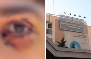 Ξυλοδαρμός 16χρονου στα Ιωάννινα: Μόνιμη βλάβη στο μάτι για τον ανήλικο που ξυλοκοπήθηκε άγρια από μια παρέα