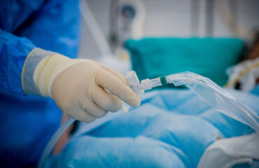 Σοκάρει η 40χρονη που τραυματίστηκε στο Κιάτο: «Το μηχάνημα μου έπιασε τα μαλλιά – Θα είχε φύγει όλο το πρόσωπο»