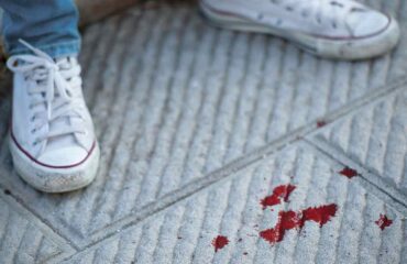 Άγριος ξυλοδαρμός 17χρονου στην Πάτρα: Παρέα συνομήλικών του τον «ξάπλωσε» με μπουνιές και κλωτσιές