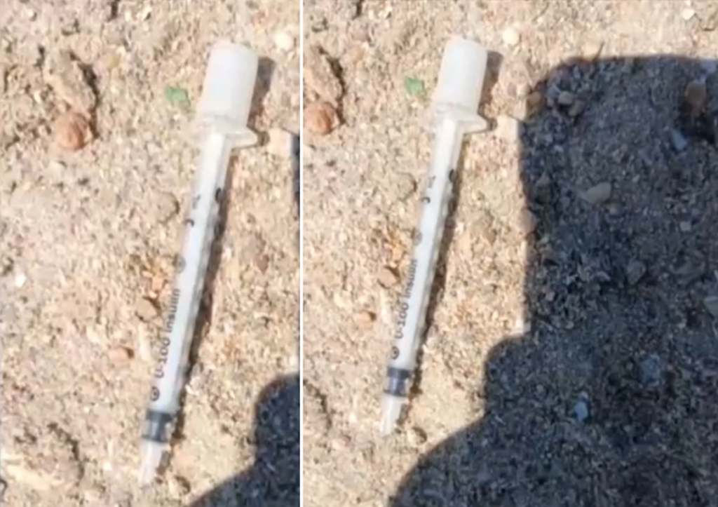 Θεσσαλονίκη: Παιδί πάτησε σύριγγα σε παραλία στους Νέους Επιβάτες
