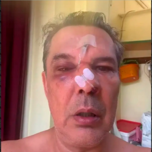 Άγριος ξυλοδαρμός άνδρα από λογιστή μέσα σε ιατρείο στο Χαϊδάρι: Του «μαύρισε» το μάτι για ασήμαντη αφορμή (βίντεο)