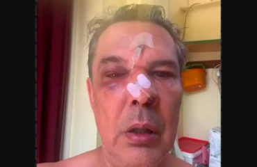 Άγριος ξυλοδαρμός άνδρα από λογιστή μέσα σε ιατρείο στο Χαϊδάρι: Του «μαύρισε» το μάτι για ασήμαντη αφορμή (βίντεο)